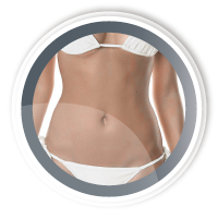 mujeres-abdominoplastia